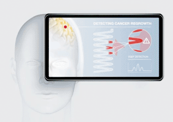 Imagen: El concepto Spatial Reach, diseñado para detectar y destruir células cancerosas residuales (Fotografía cortesía de Team Consulting).